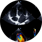 cardiologue agadir